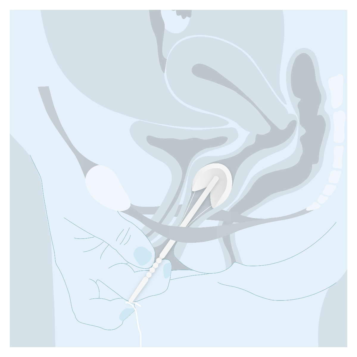 contrelle_activgard_correct_position