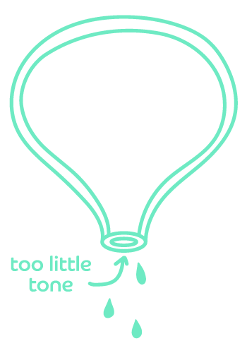 diagram-showing-bladder-weakness-stress-urinary-incontinence-contrelle